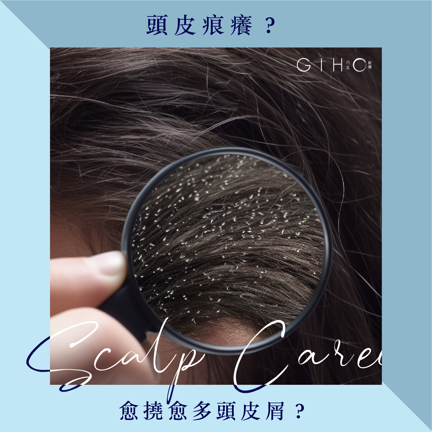 頭皮痕癢？愈撓愈多頭皮屑？